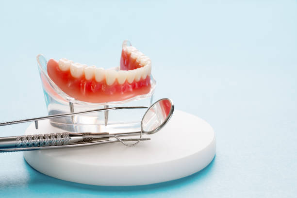 Full Mouth Reconstruction in Kirksville, MO