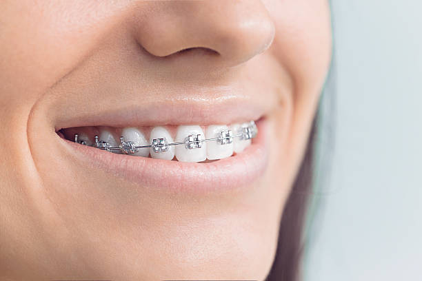 Best Invisalign and Clear Aligners  in Kirksville, MO